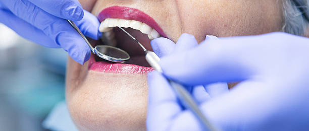 Best Emergency Dentist for Knocked-Out Tooth in Los Lunas, NM